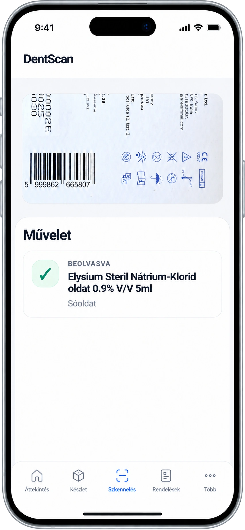 DentScan szkennelési művelet telefon mockup vonalkódolvasással és műveletkártyával
